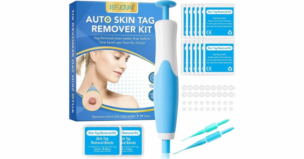 Skin Tag Removal Kit Review
